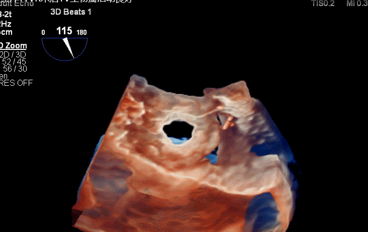 1622714957184096007.gif 6.gif