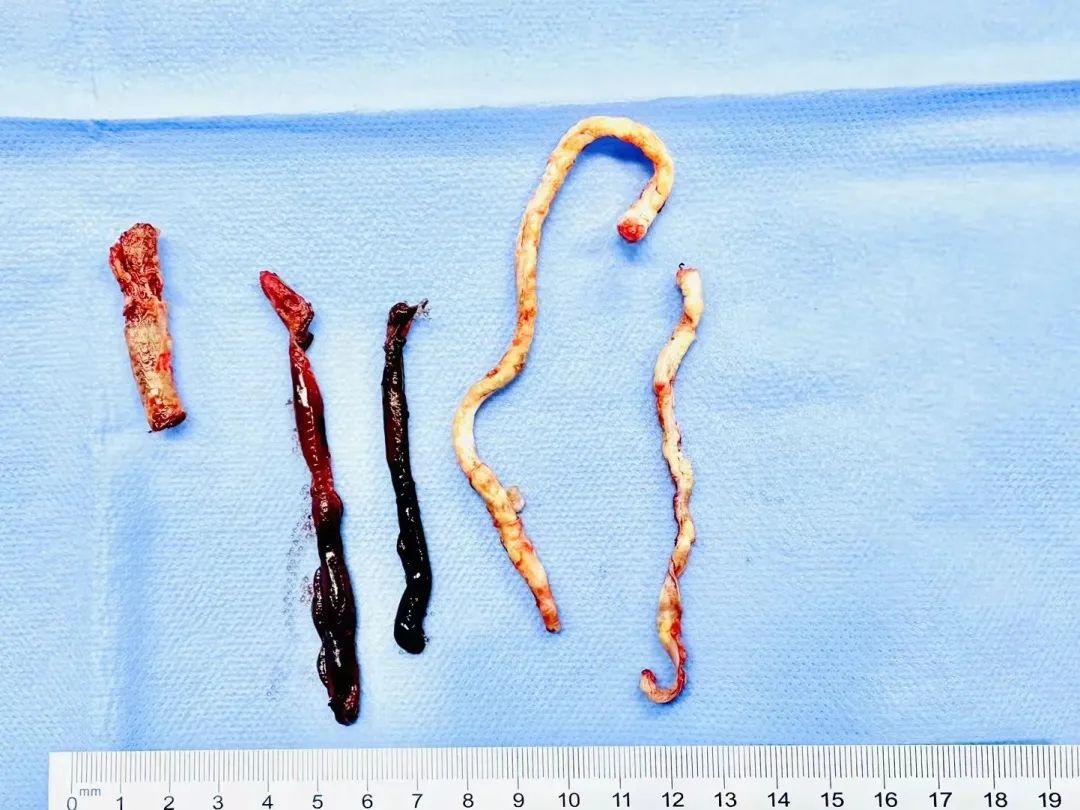 1701824143500302.jpg 2.jpg