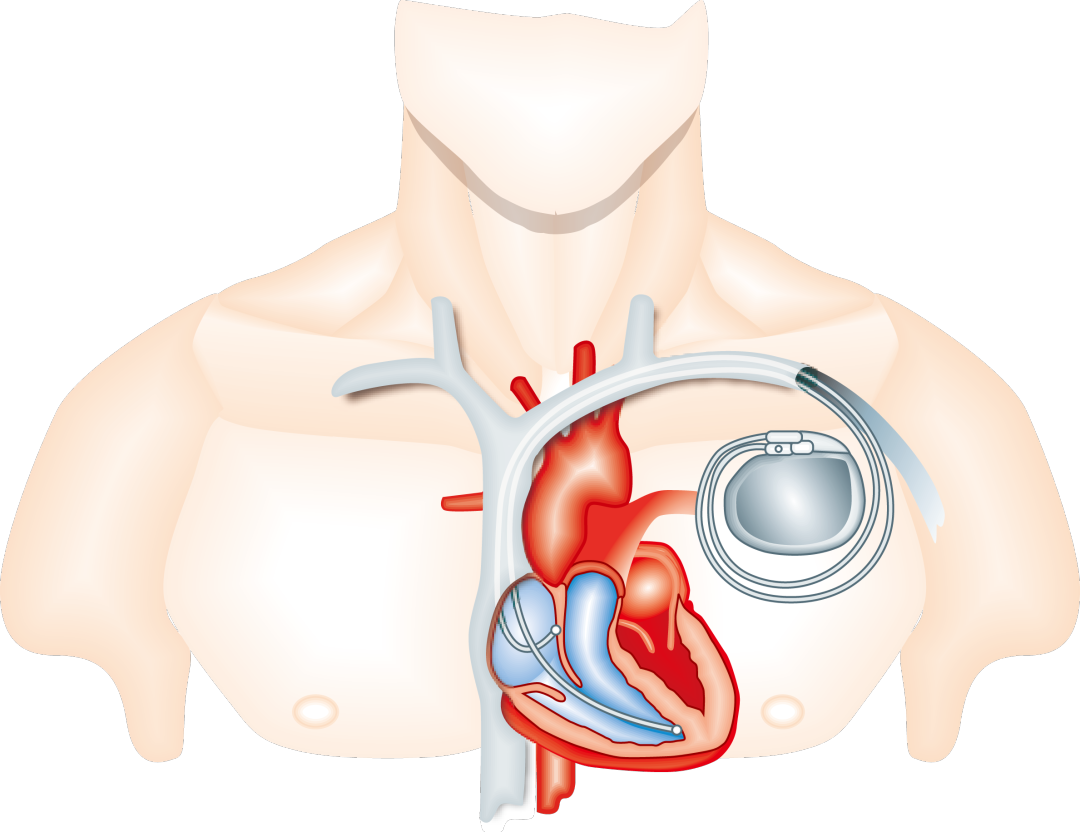 1704159784429716.png 640 (3).png